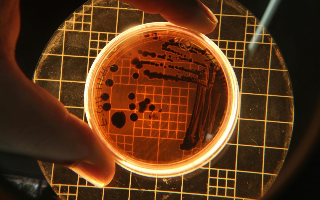Petrischale mit Keimen unter Rastermikroskop